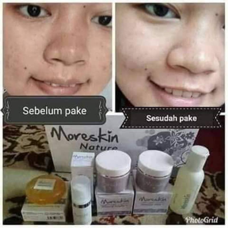 MORESKIN NATURE