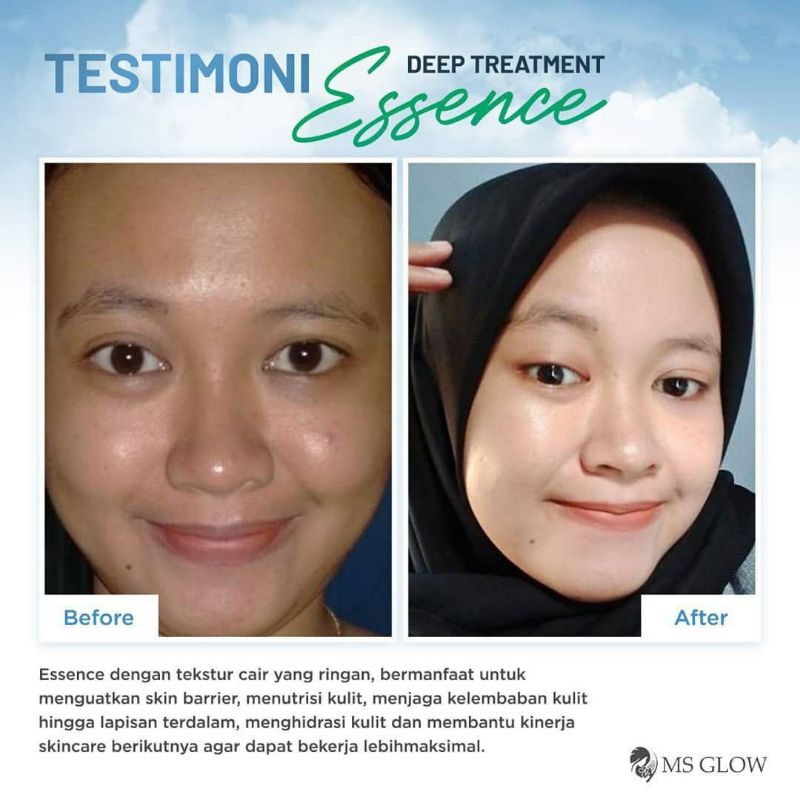 DEEP TREATMENT ESSENCE