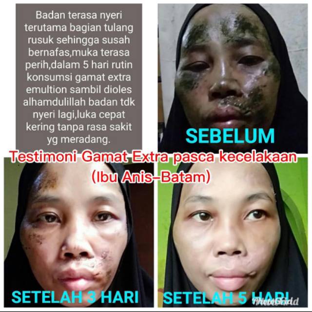 Meregenerasi sel..