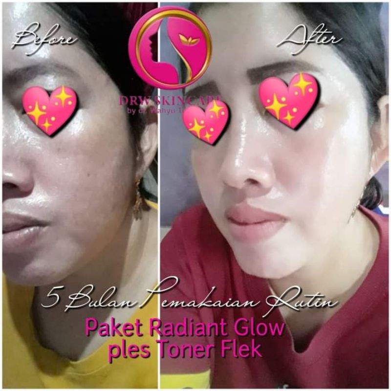 paket radiant glow