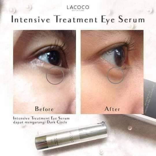 INTENSIVE TREATMENT EYE SERUM