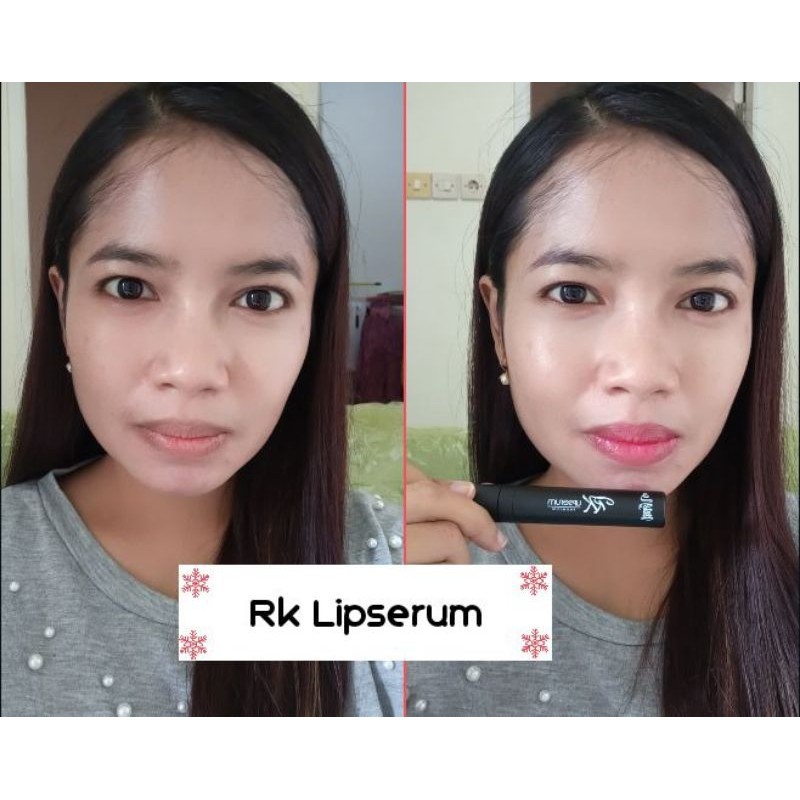 Rk Lipserum
