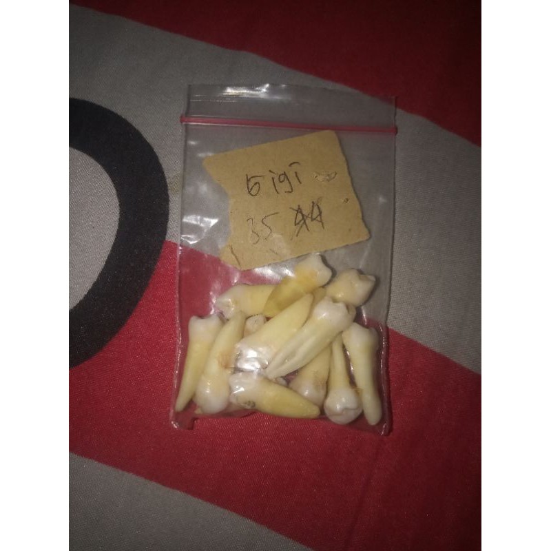 GIGI PREMOLAR 35