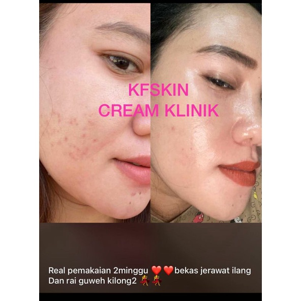 kfskin klinik