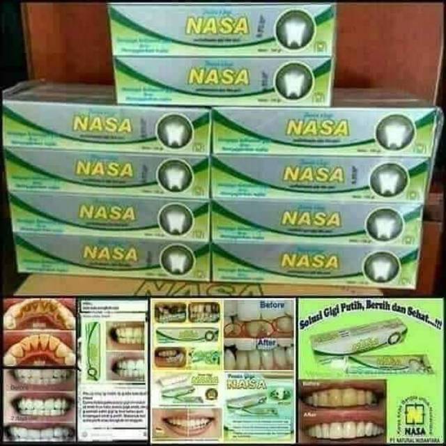 Pasta gigi nasa
