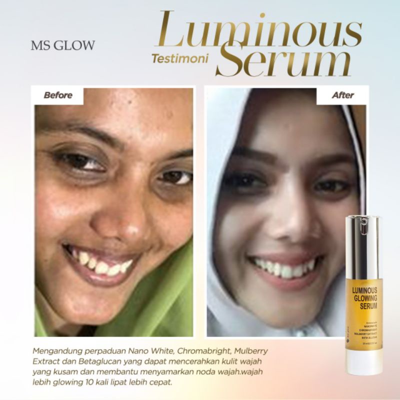 Luminous Glowing Serum MS Glow