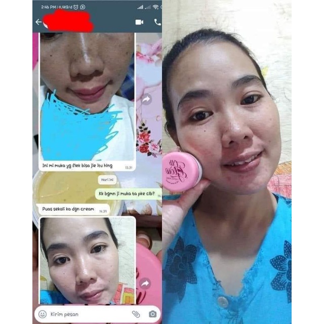 clbglow ORI