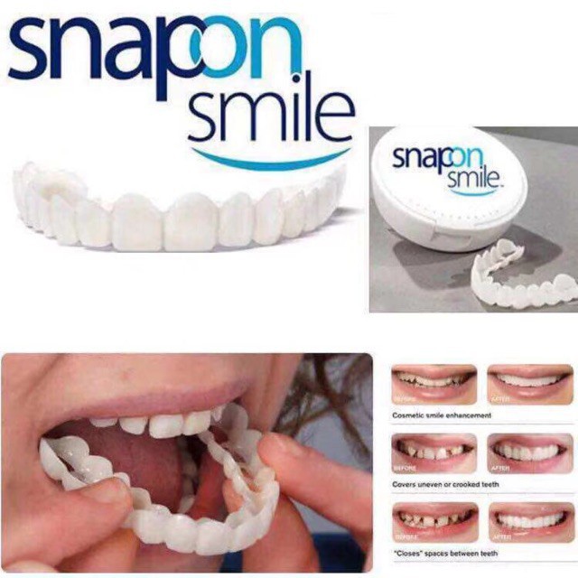 Snap On Smile HL