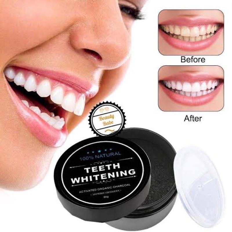 TEET WHITENING