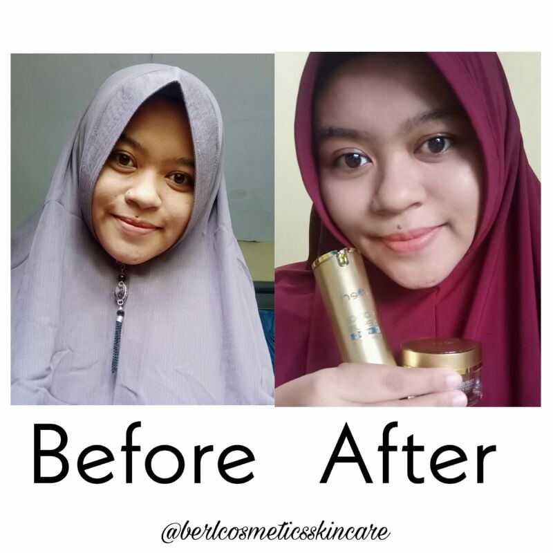 Facial Serumberl