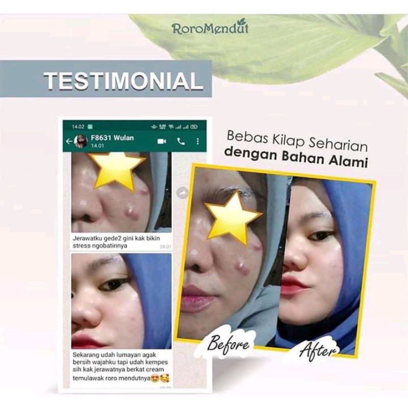 Paket Cream Roro Mendut