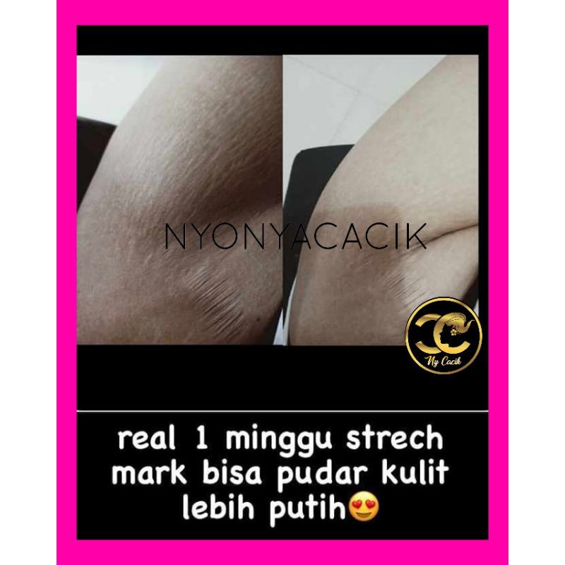 SABUN SUSU PLUS GLUTATION NYONYA CACIK