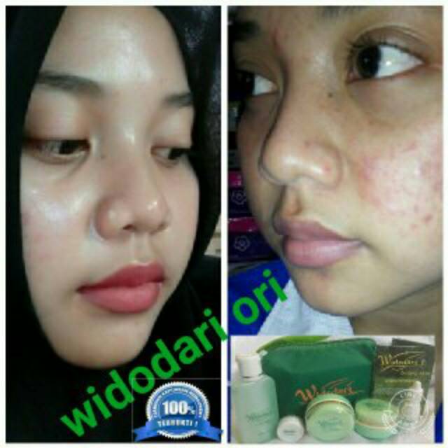PROMO.   Krim Widodari