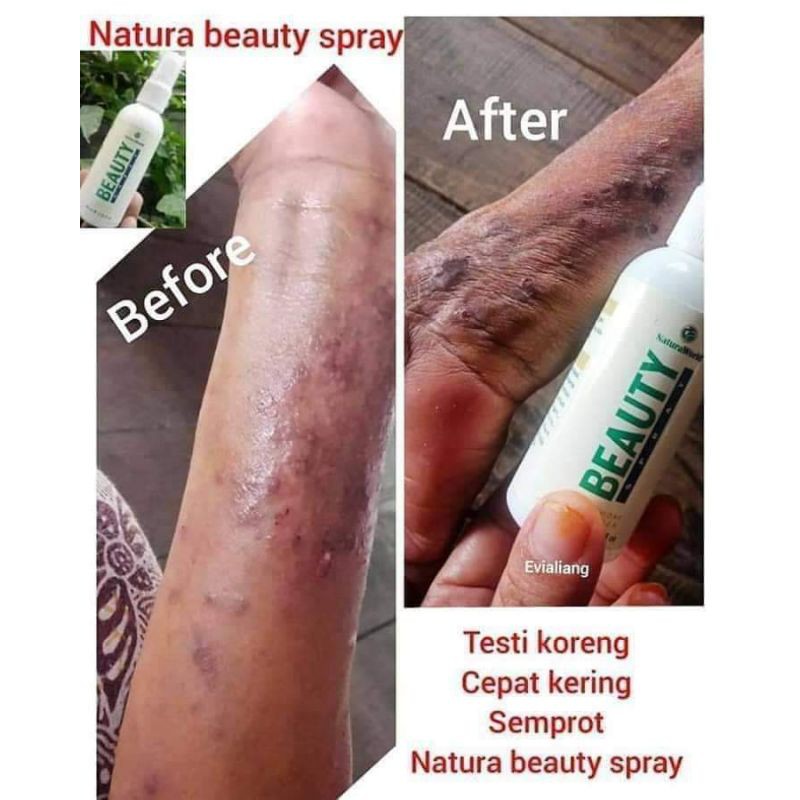 BEAUTY SEPRAY