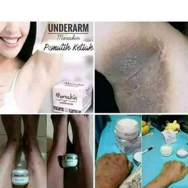 Moreskin underarm