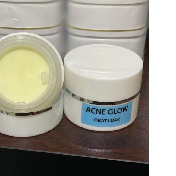 ➯ CREAM MALAM ACNE GLOW ♦