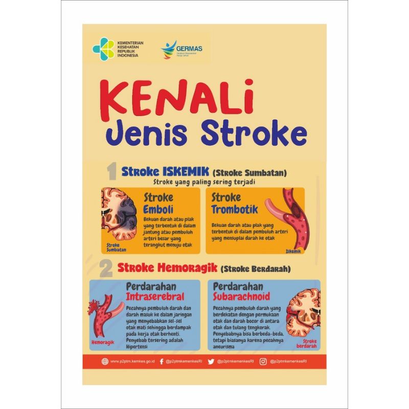 Poster Kenali Jenis Stroke
