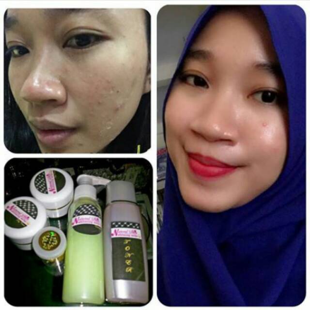 Naturalskin