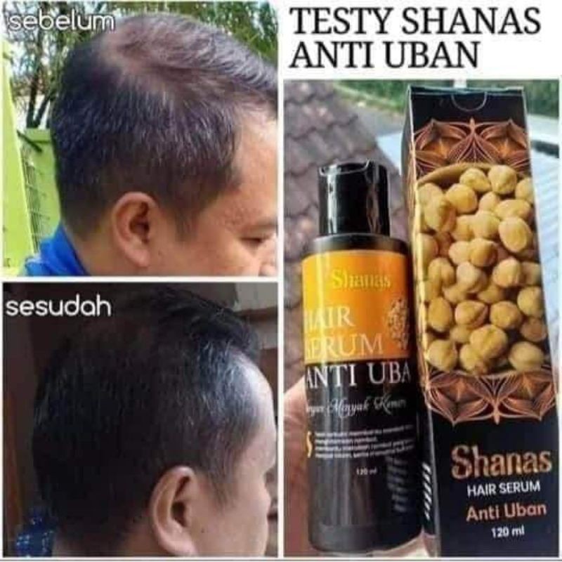 Anti uban