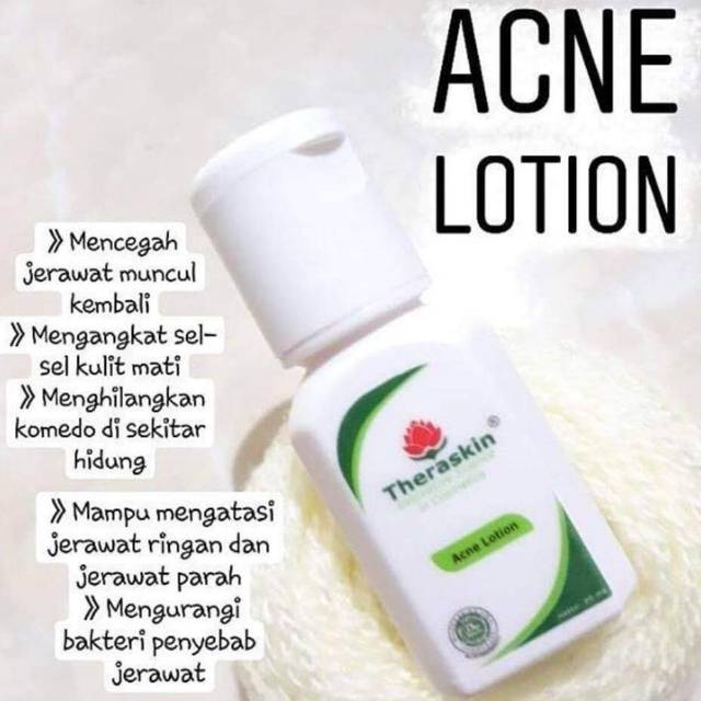Acne lotion