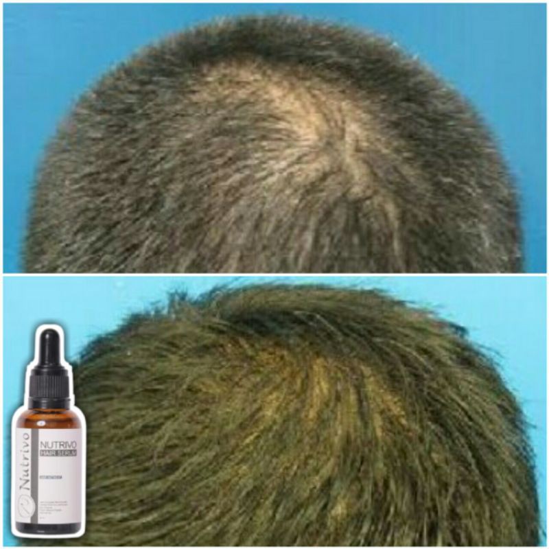 NUTRIVO HAIR POWER