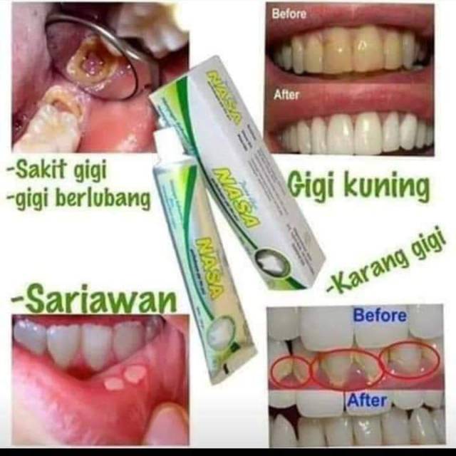 Pasta gigi Nasa ( PGN )