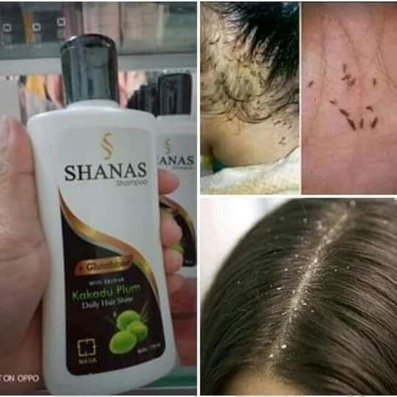 shanas shampo nasa