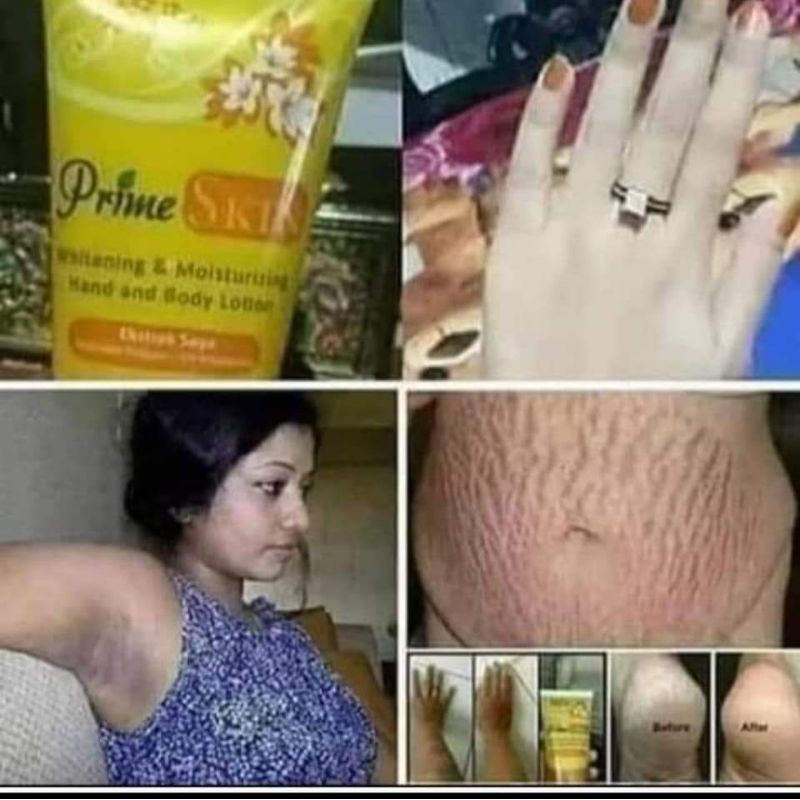 HENBODY PRIMESKIN