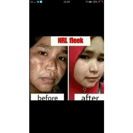 (BISA COD) NRL ORIGINAL paket ekonomis