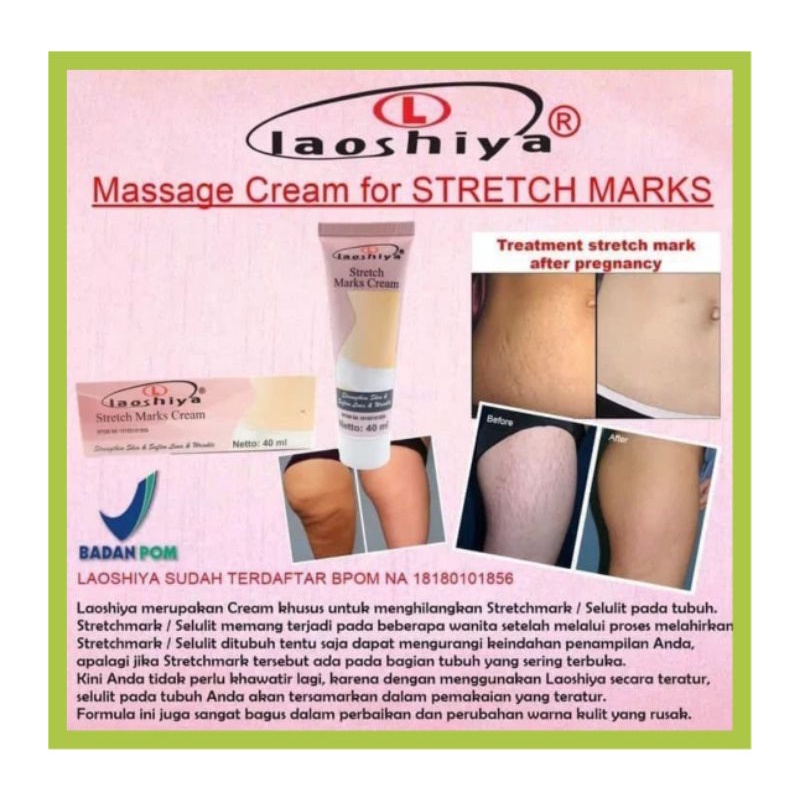 LAOSHIYA STRETCH MARKS CREAM