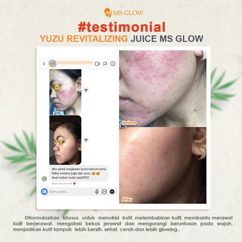 YUZU REVITALIZING