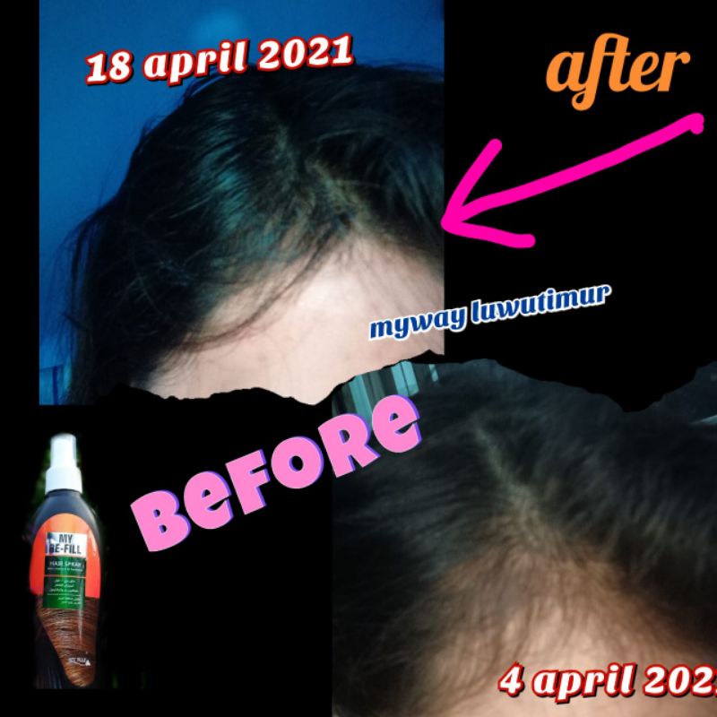 sampoh penumbuh rambut