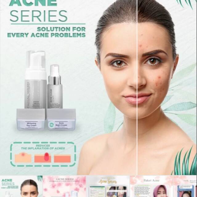 Ms glow paket acne