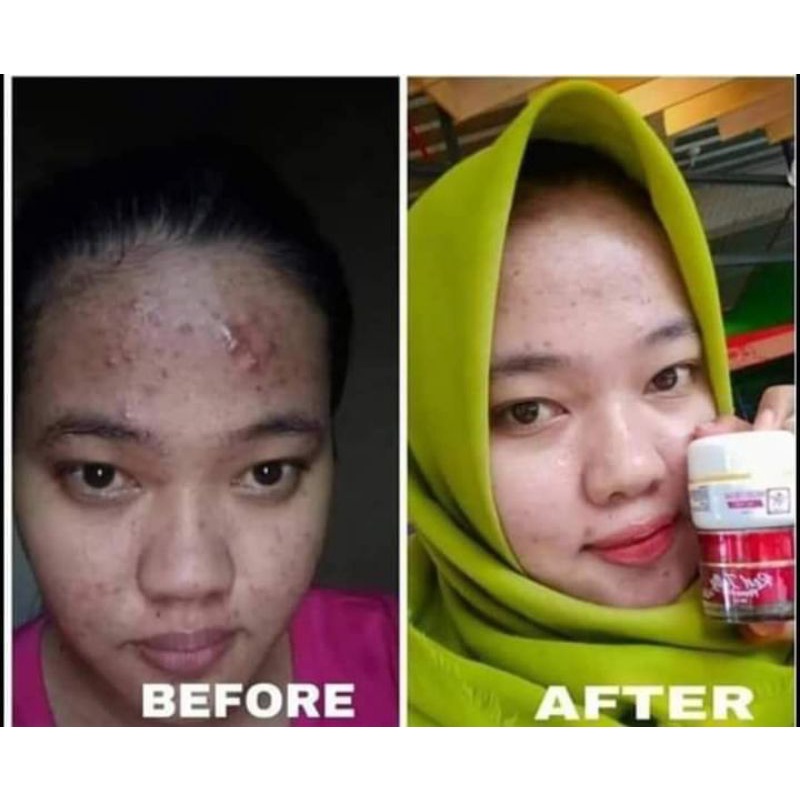 RK GLOW KOSMETIK