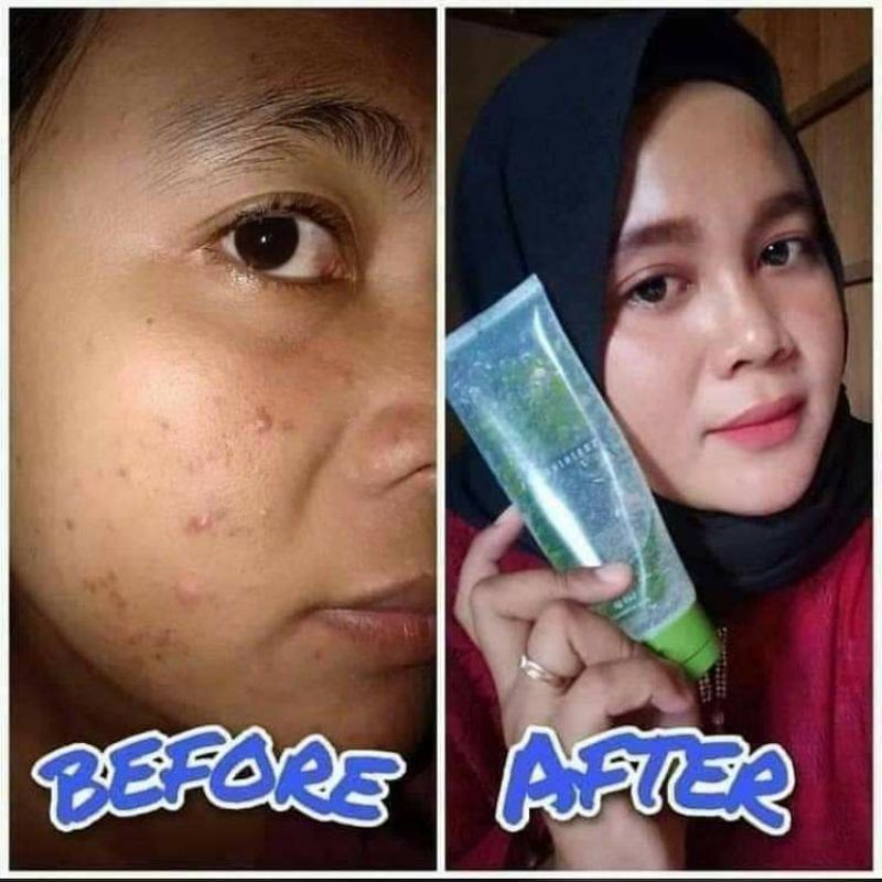 natura aloevera