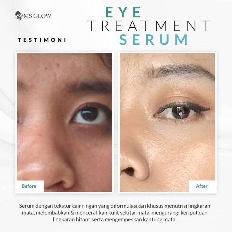 MSglow skincare