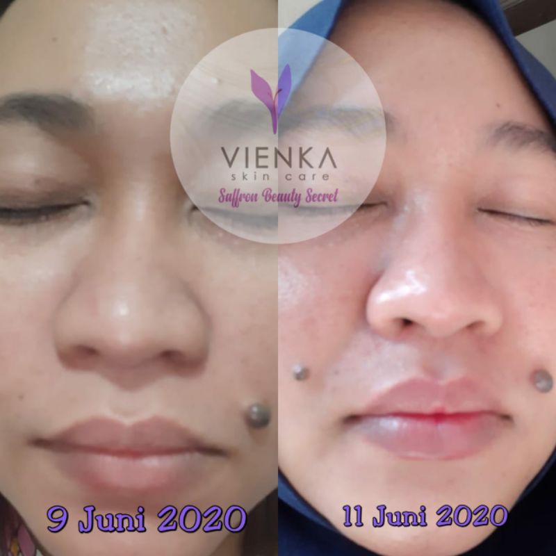 Paket Basic Vienka