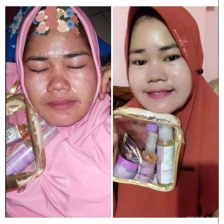 umibeautycare,pketbasic