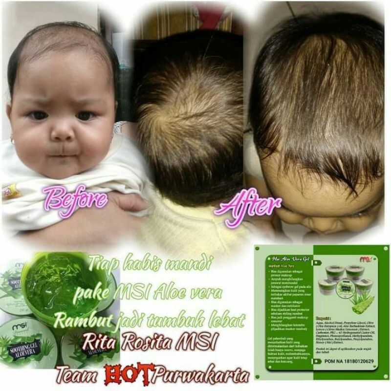 aloe Vera MSI