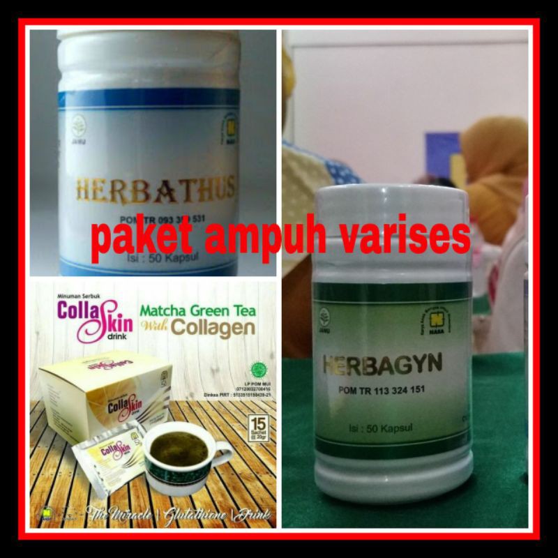PAKET VARISES