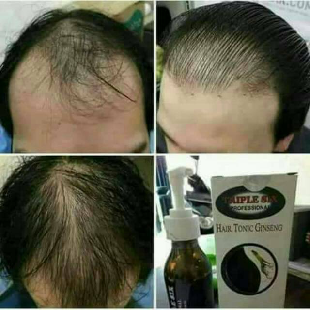 hair tonic ginseng