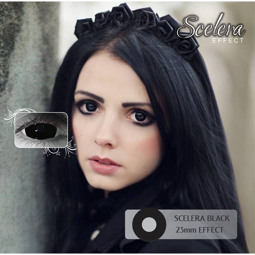 sclera