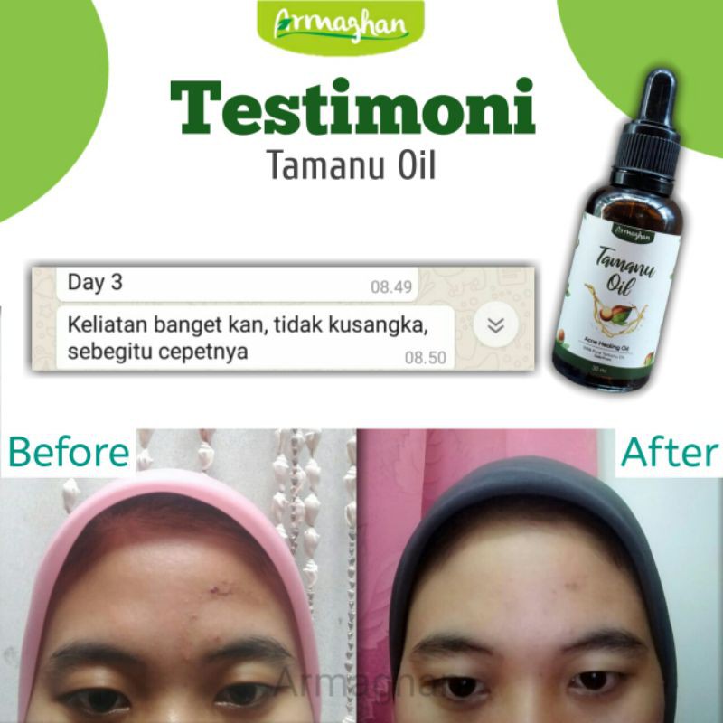 TAMANU magic oil