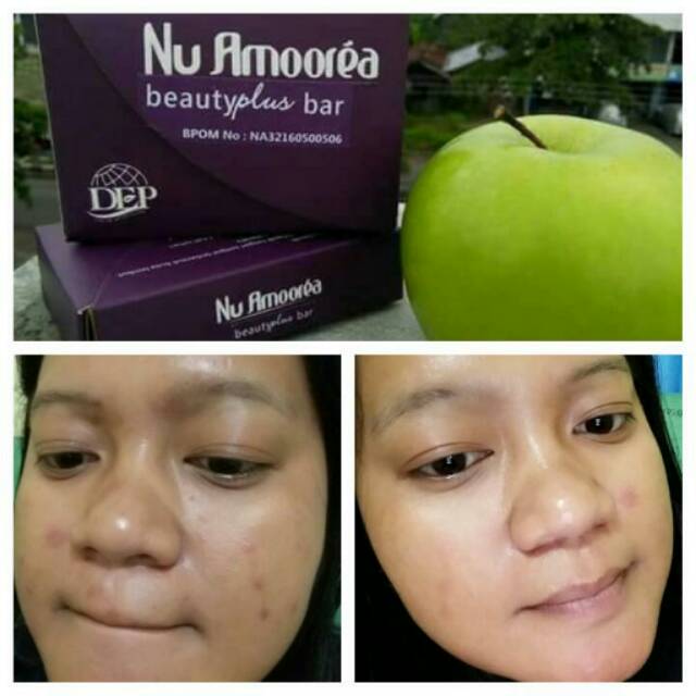 Nu amoorea stemcel 40 gr