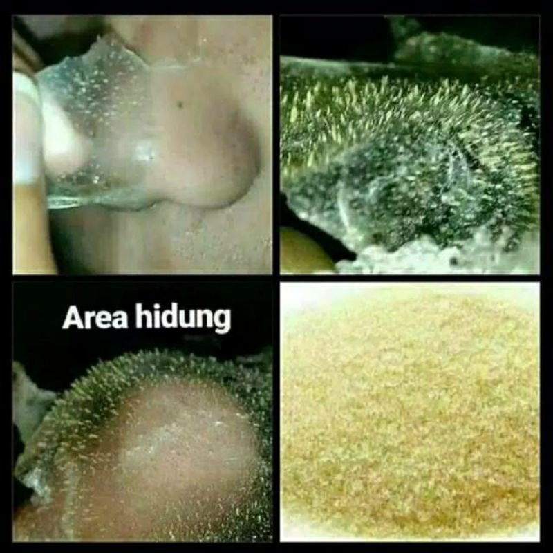 masker komedo Glatin