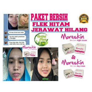 Moreskin DAY Cream