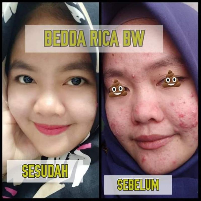 masker Beddarica