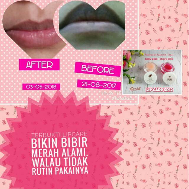 Lipcare sr12