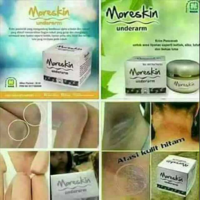 Moreskin underarm