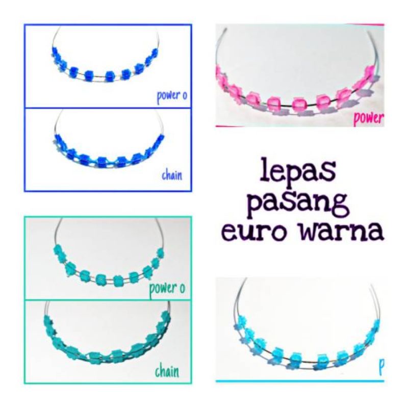 behel lepas pasang bracket warna